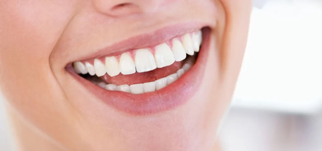 aligner dents orthodontie gisors Parcours de soins Dr Luca MANGIARACINA - Orthodontie Gisors