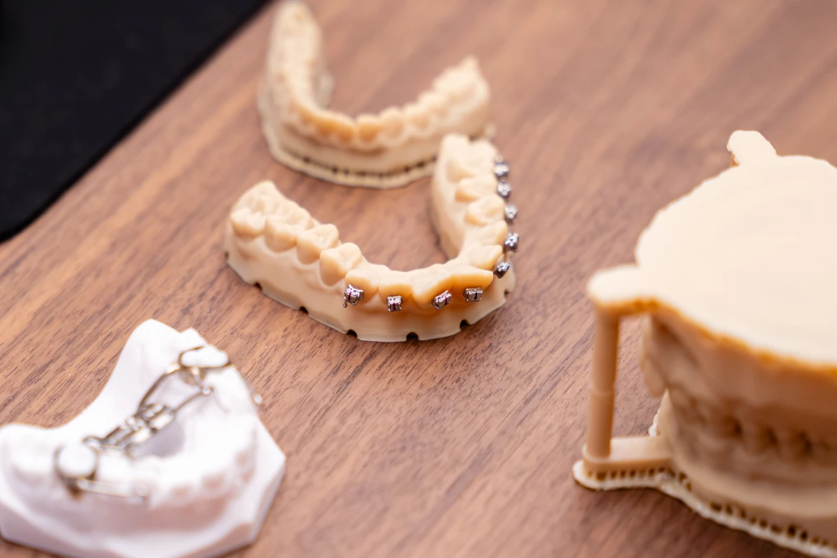 orthodontie gisors laboratoire